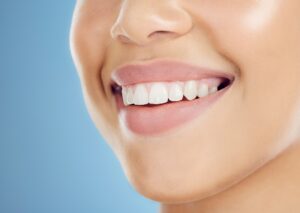 Zahnumformung Gelnhausen Veneers