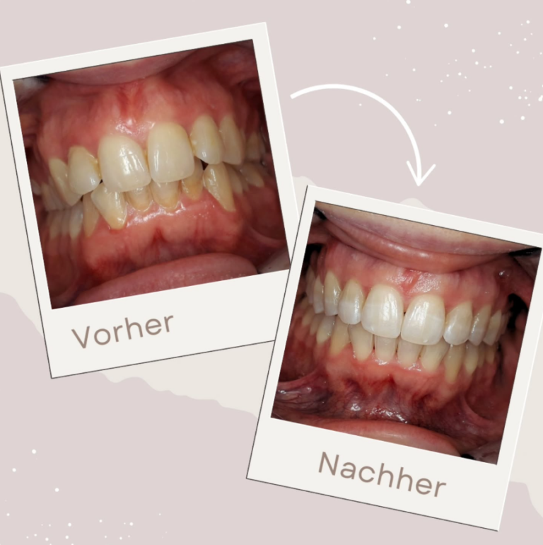 Ergebnisse Gelnhausen Smile